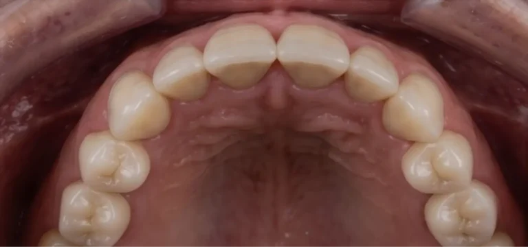 , (14)